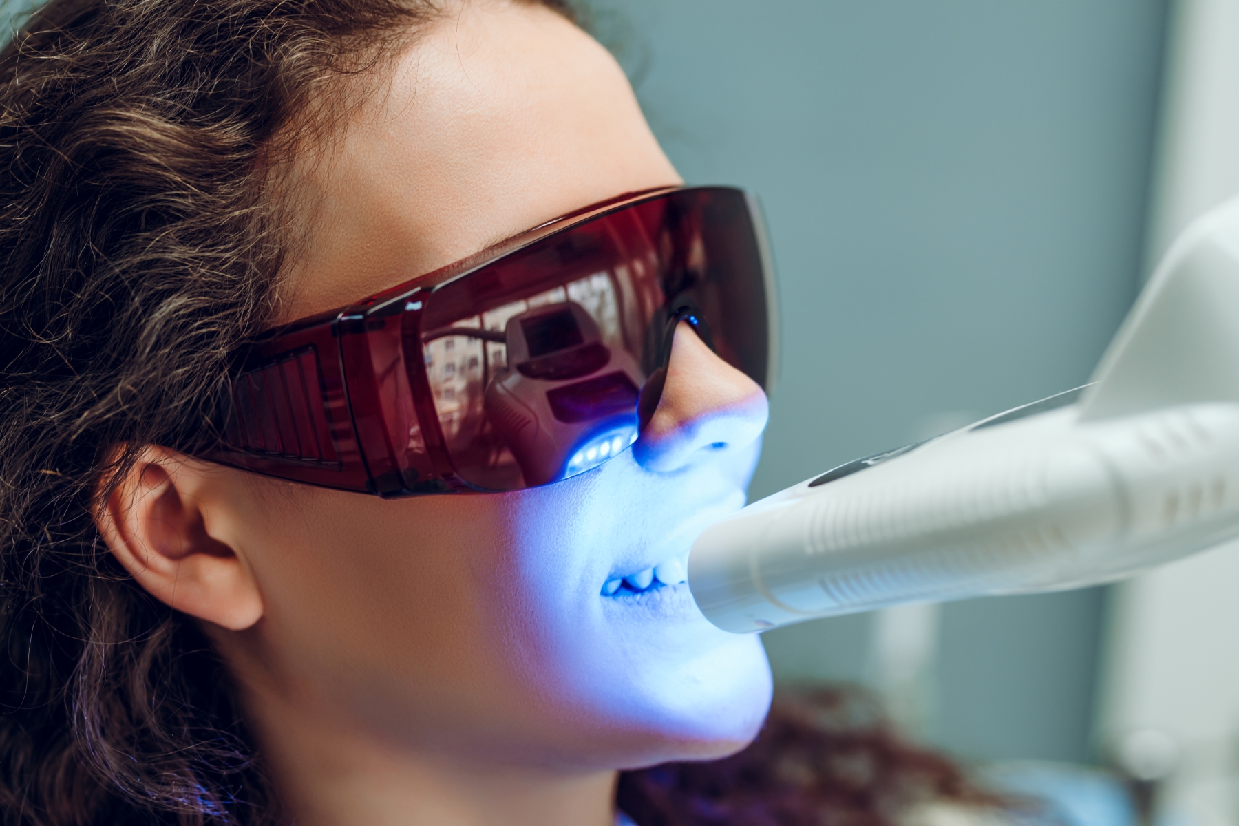 Lunettes UV pour blanchiment dentaire